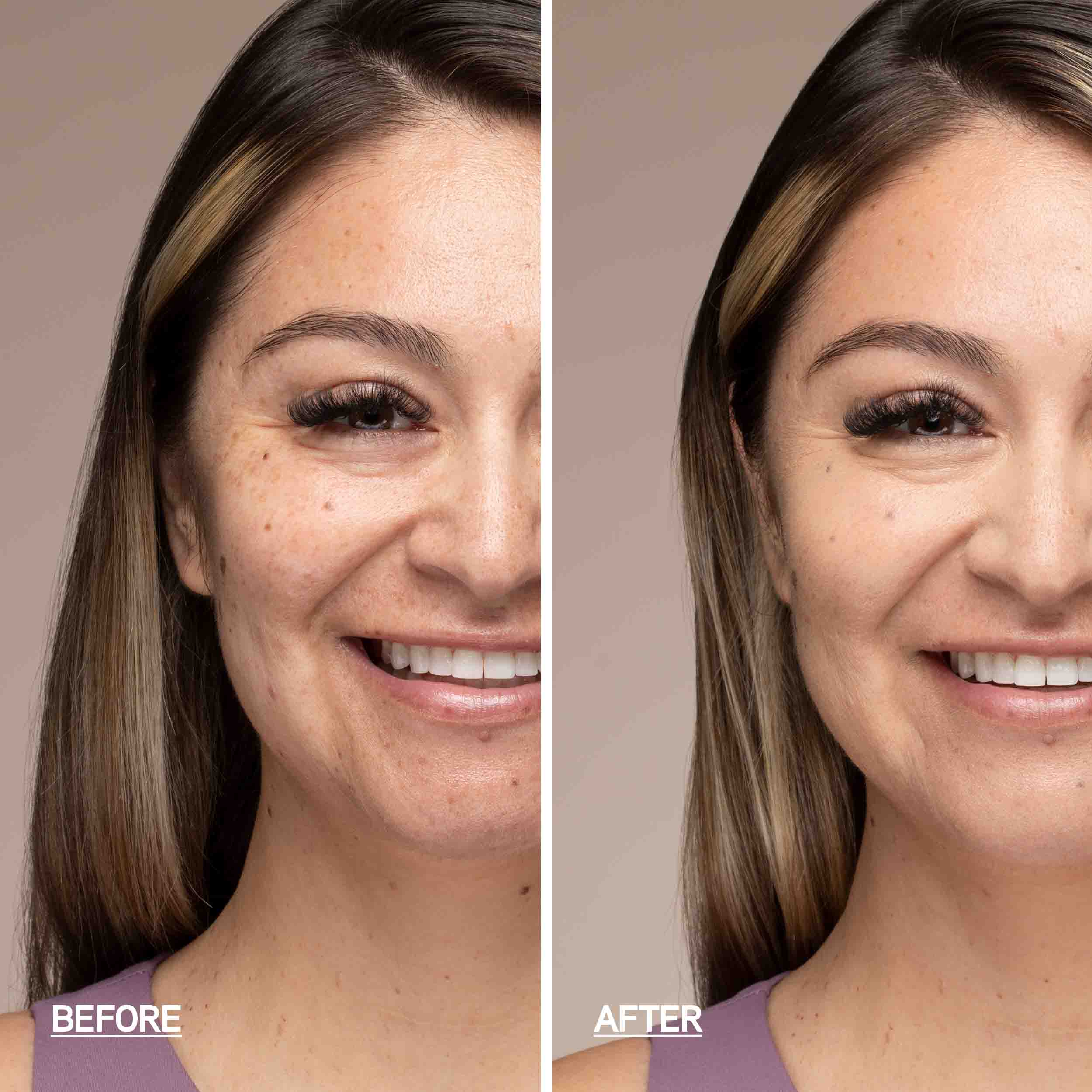 1712794_4_Before-After_f1b4f7fe-b231-45f2-bd60-37736296cd03.jpg